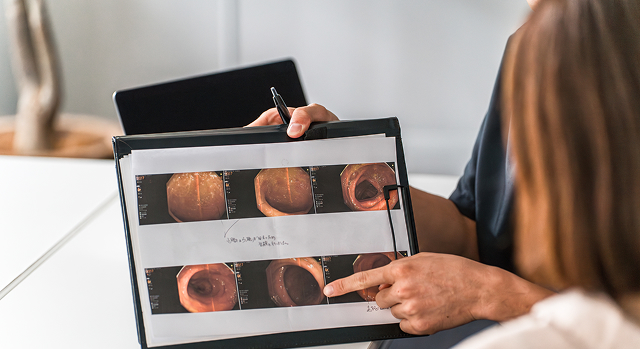 胃内視鏡検査（胃カメラ）