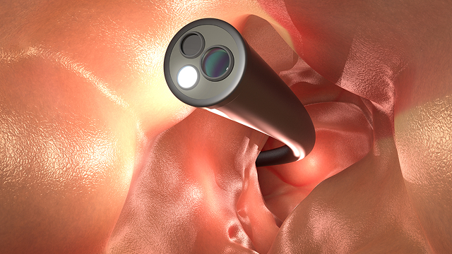 胃内視鏡検査とは？