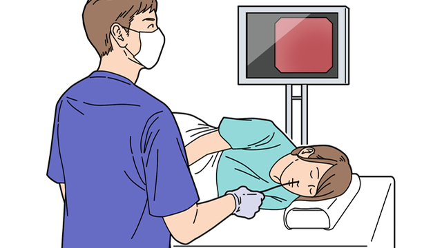 胃内視鏡検査とは？